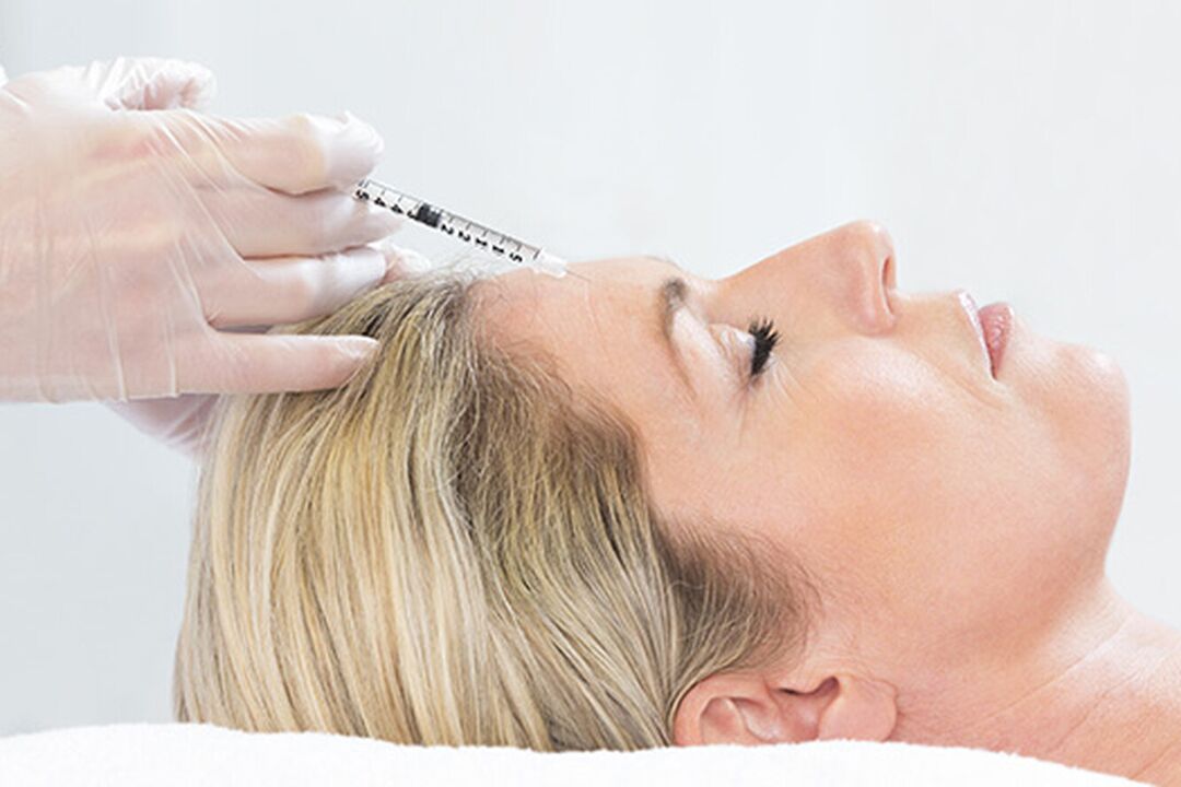 Plazmolifting, yüz cildi gençleştirmenin bir enjeksiyon yöntemidir. 